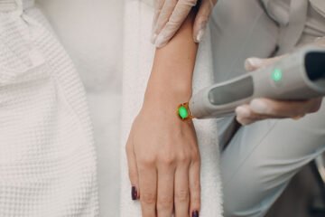 Laser Hair Removal treatments