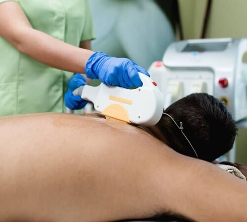 laser hair removal procedure for man laser hair removal procedure for man