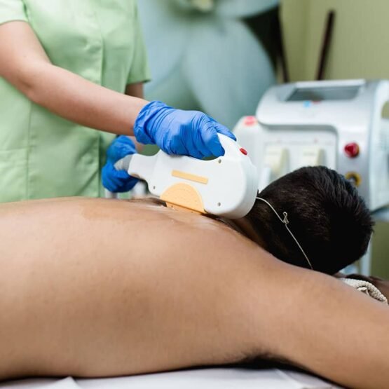 laser hair removal procedure for man