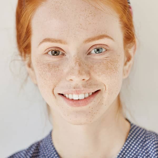 Treatments for uneven skin pigmentation