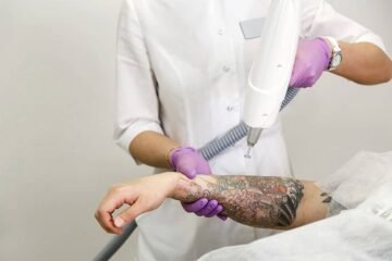 professional tattoo removal with laser Wisconsin